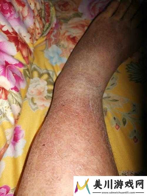 淑娟两腿间又痒了